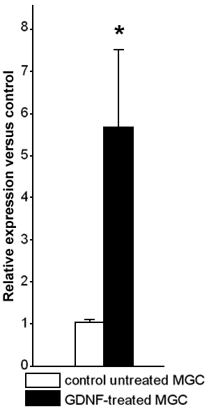 (15 K)