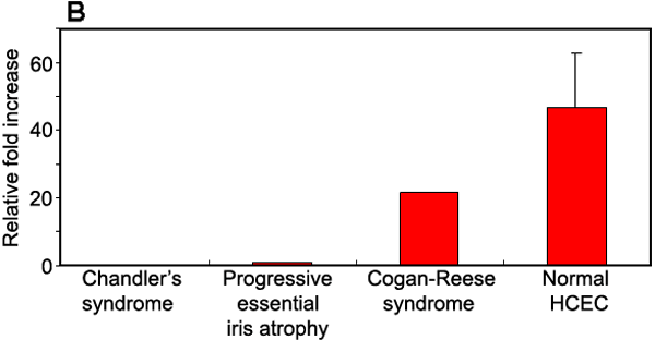 (17 K)