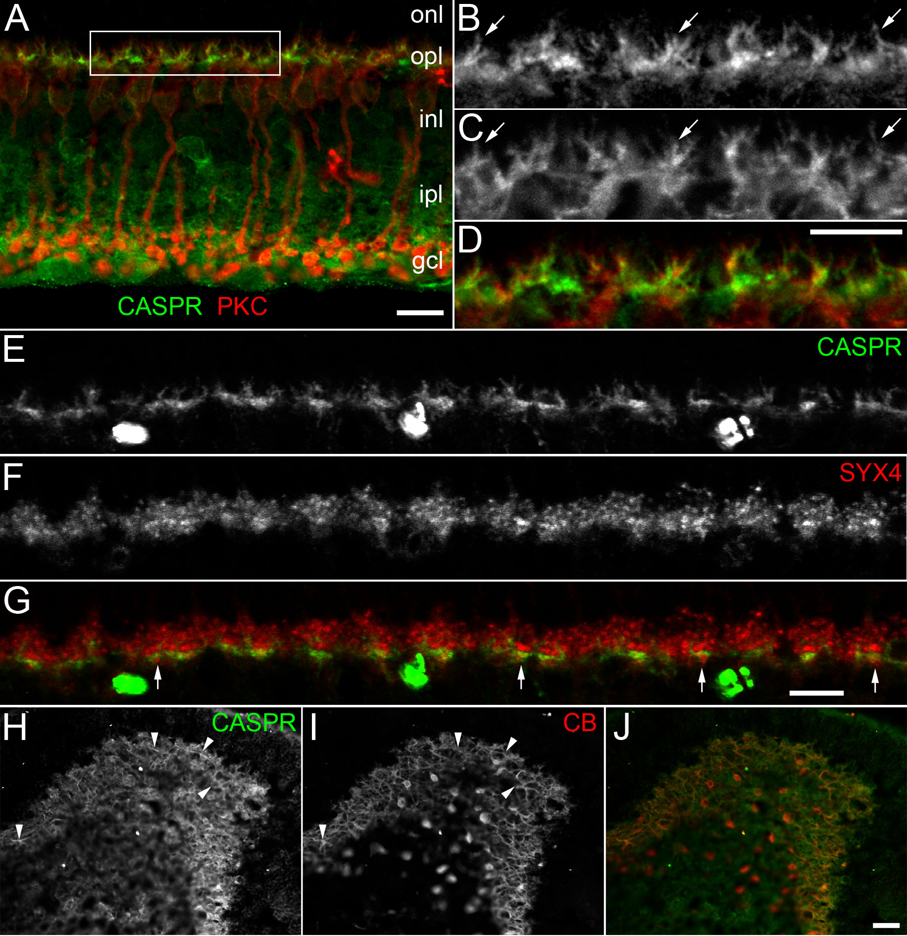 Labelled Blood Vessels