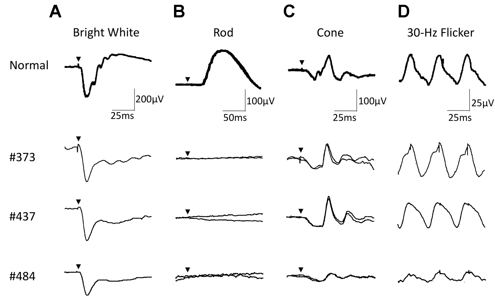 Waves Amplitude