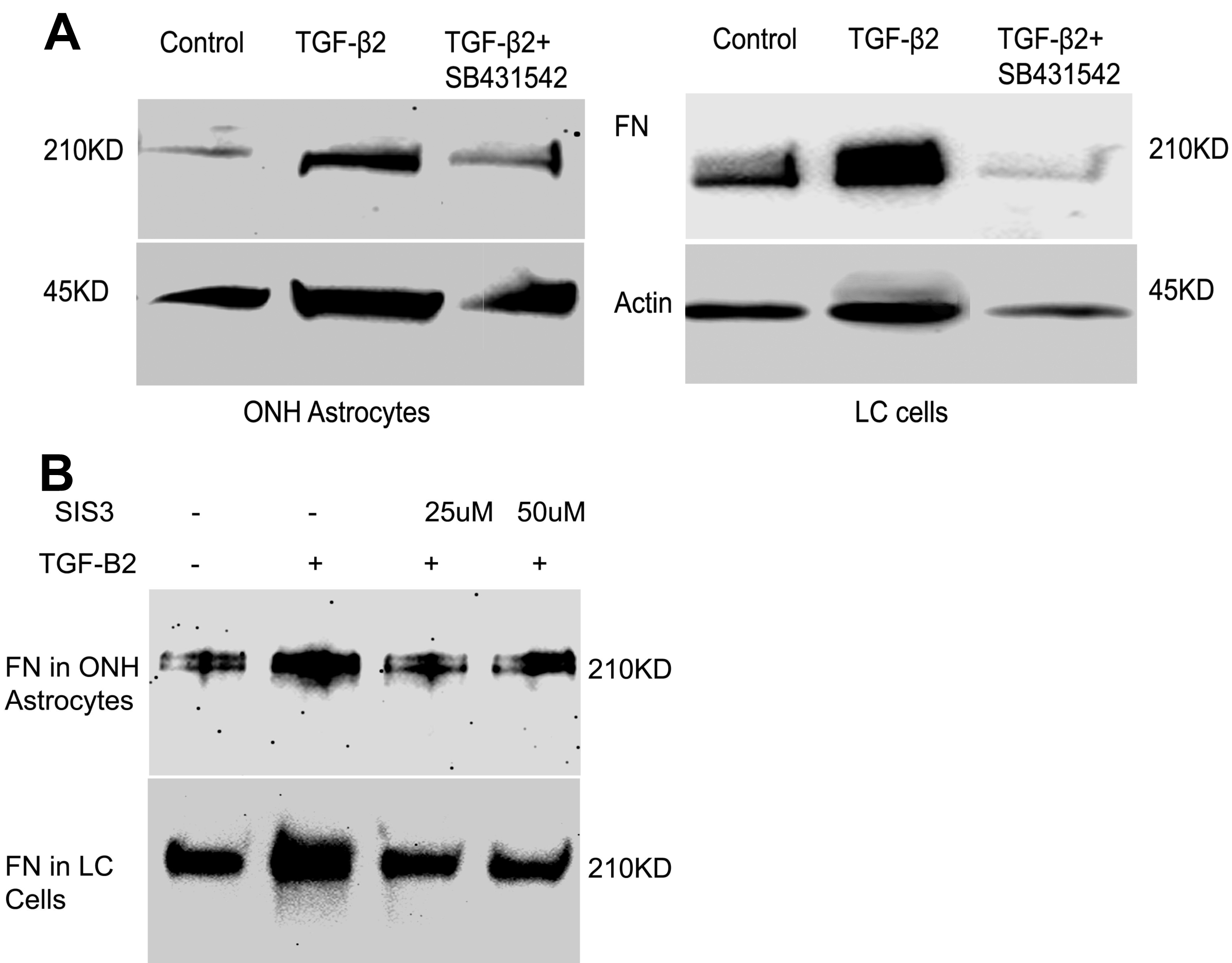 Fibronectin Western Blot