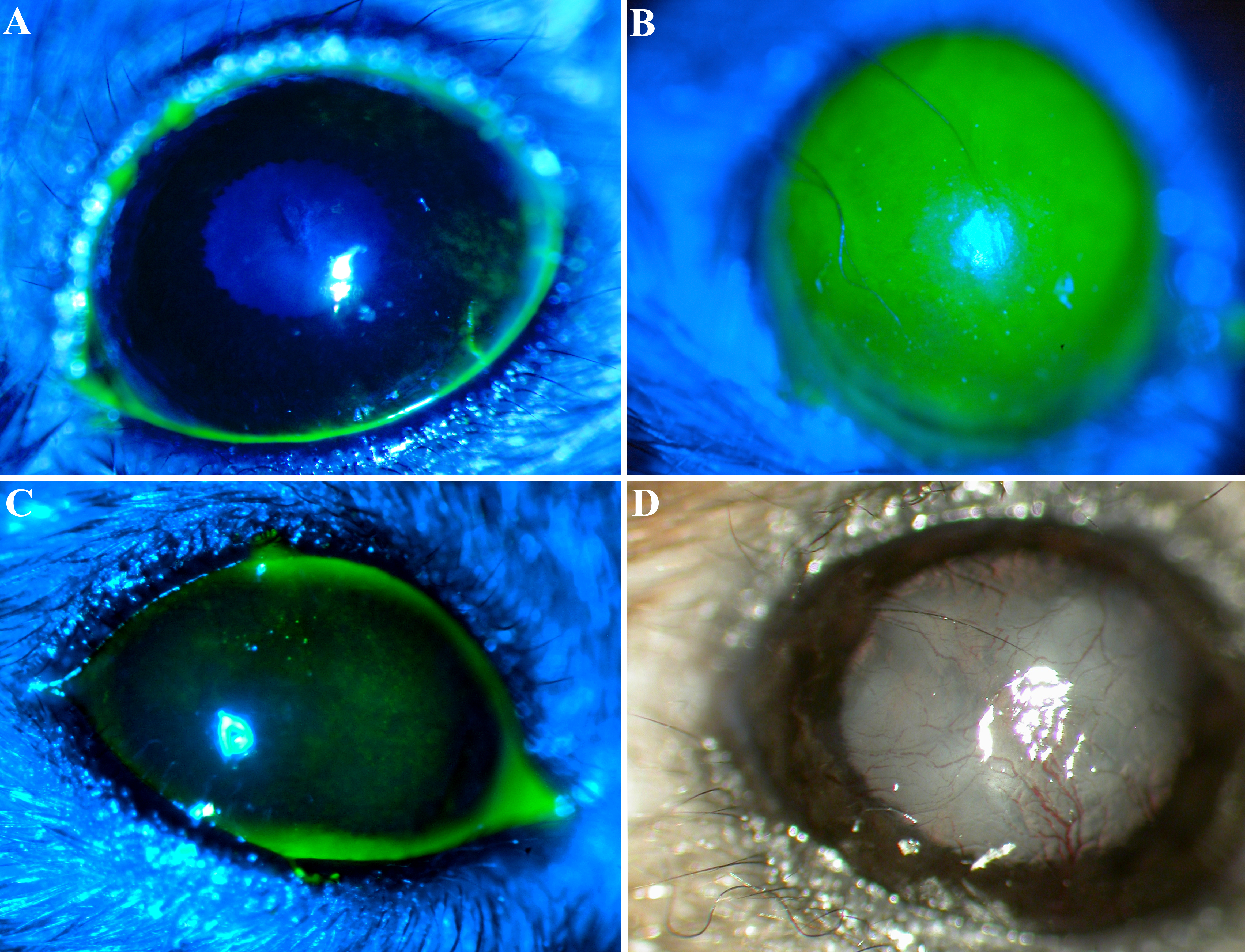 Corneal Epithelial Defect