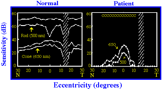 perimetric profiles