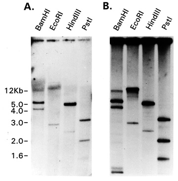 Southern blot of P-1 clone and human genomic DNA