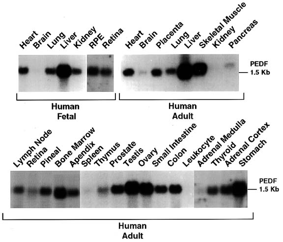 Multitissue northern blot of fetal and adult human tissues