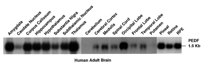 Northern blot of adult human brain areas.