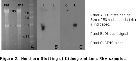 Northern of kidney and lens RNAs