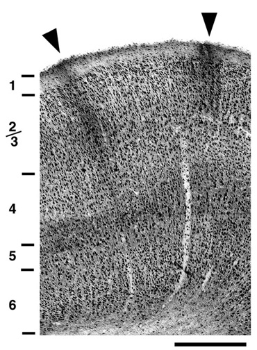 Figure 1. NMDAR1 immunoreactivity in area 17 of a 4 week old kitten. 