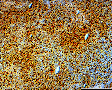 Figure 1. NMDAR1 immunoreactivity in area 17 of a 4 week old kitten. 
