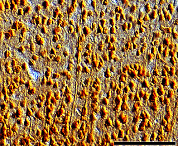 Figure 1. NMDAR1 immunoreactivity in area 17 of a 4 week old kitten. 