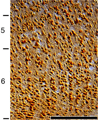 Figure 1. NMDAR1 immunoreactivity in area 17 of a 4 week old kitten. 