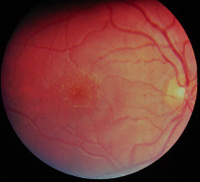Fundus photograph, individual #4027