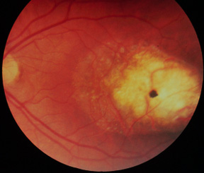 Fundus photograph, individual #3030, left eye