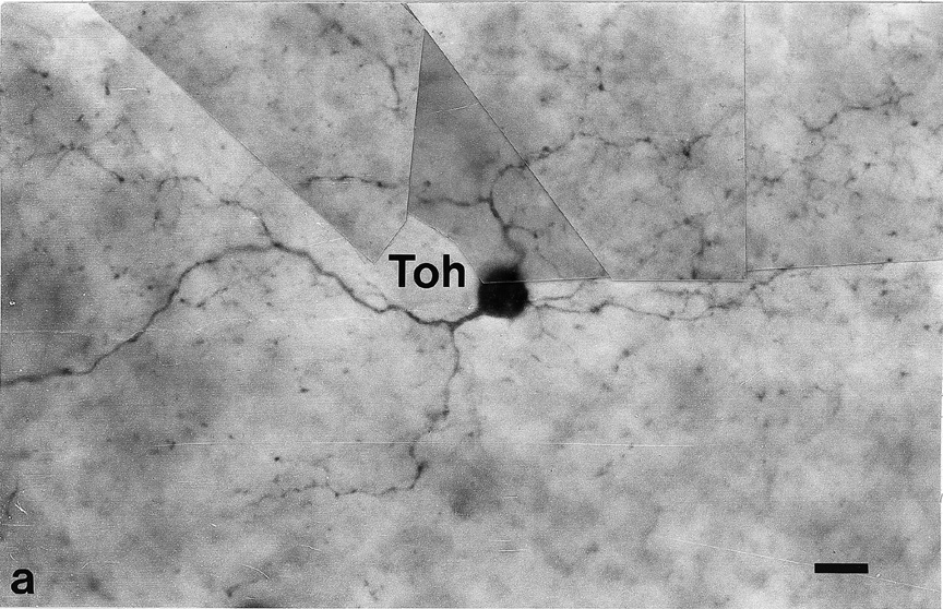 LM view of a wholemount Toh-IR cell