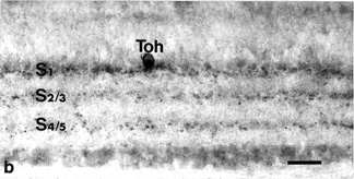Vibratome vertical section of Toh-IR amacrine cell