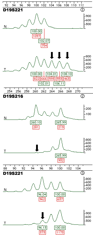 (11 K)